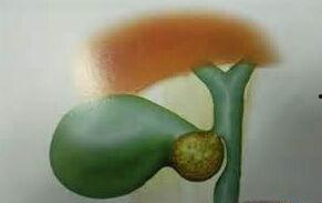 胆结石吃白瓜,白瓜助力健康生活